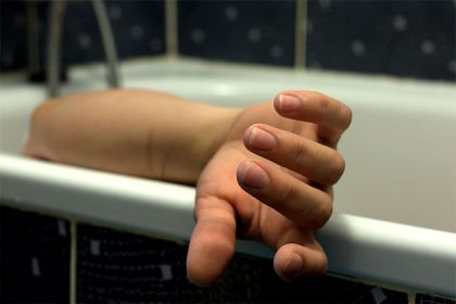 How to Identify a Bloated Dead Body: Signs and Symptoms